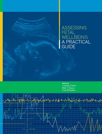 Assessing Fetal Wellbeing - A Practical Guide